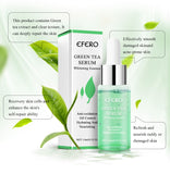 Green Tea Tree Oil Treatment for Acne