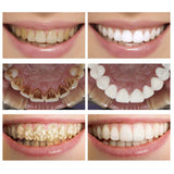 Teeth Whitening Serum