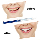 Teeth Whitening Kit 44% Peroxide Dental Bleaching System